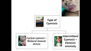 Cyanosis  Pediatrics [upl. by Woodford145]