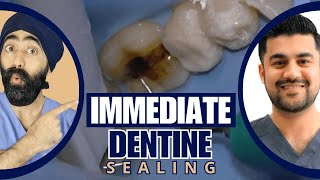 Immediate Dentine Sealing Tutorial Part 1  PDP173 [upl. by Eleaffar]