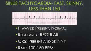 Breaking Down BASIC Dysrhythmias [upl. by Sseb542]