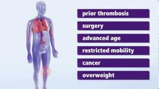 About Thrombosis Symptoms and risk factors for deep vein thrombosis DVT [upl. by Anihc]