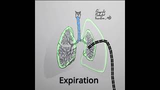 Pneumothorax Treatment Animation variation 4 shorts medical [upl. by Cyndia]