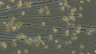 foraminiferal rhizopodia [upl. by Gerrard207]