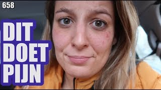 PUISTEN WEGSNIJDEN  SUPER VEEL PIJN  VLOG 658 [upl. by Annahsar]