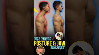 Fix NECK Posture Exercises [upl. by Cardie]