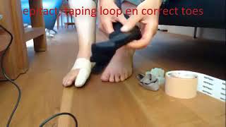 Hallux valgus hulpmiddelen epitact taping loop en correct toes Alprovi [upl. by Furlong610]