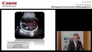 Dr Laurent Guibaud  CNS Beyond 2nd Trimester ISUOG Guidelines [upl. by Madge160]