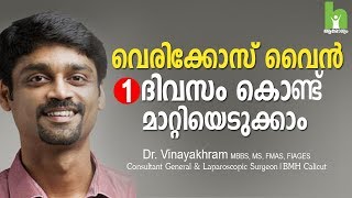 വെരികോസ് വൈൻ മാറ്റാൻ 2 വഴികൾ  varicose veins malayalam health tips [upl. by Nauh918]