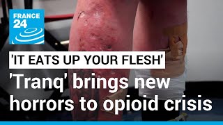 It eats up your flesh Tranq the new drug worsening Americas opioid epidemic • FRANCE 24 [upl. by Eecyal18]