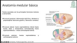 AStrocitoma medular en pediatrìa [upl. by Hooker]