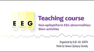 Nonepileptiform EEG abnormalities – Slow activities 6 ILAEAO amp ASEPA EEG teaching course [upl. by Bridge970]