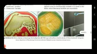 Apurba S Sastry Microbiology Cholera Halophilic vibrio amp aeromonas infections part 2 [upl. by Neersan]