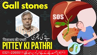 Gall Stone pittey ki pathri  By Dr Fahim [upl. by Aratal101]