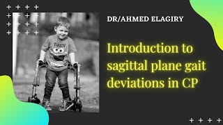 Introduction to sagittal plane deviations of gait in CP [upl. by Sone]