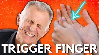 Top 3 Ways to Treat Trigger Finger or a Snapping Finger or Thumb [upl. by Lanevuj]