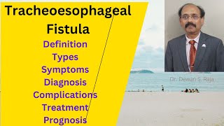 Tracheoesophageal Fistula [upl. by Otineb]