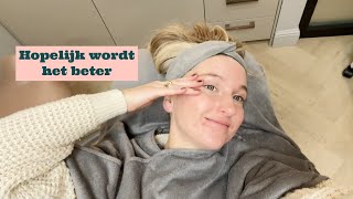 ACNE BEHANDELING FAVO HEMA ITEMS amp UITETEN  VITA CLEO VLOG 148 [upl. by Ahselat]