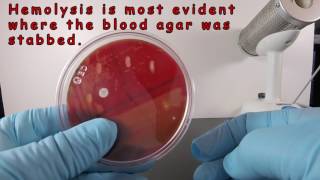 Beta Hemolysis on Blood Agar [upl. by Horn221]