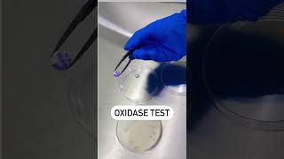 Oxidase Reaction Test  Disc Oxidase Test  Positive Oxidase Reaction microbiology youtubeshorts [upl. by Rehsu]