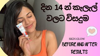 කැලැල් නැතිකරන Lighting glowing cream  Before and after results  Eventone C crem  100 recommend [upl. by Alleon808]