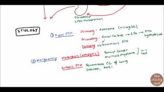 Hypercalcemia for USMLE Step 1 and USMLE Step 2 [upl. by Ahsemo]