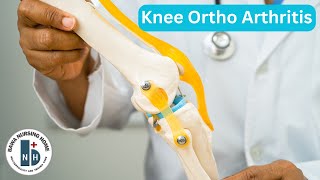 Knee Ortho Arthritis ਹੱਡੀਆਂ ਦਾ ਗਠੀਆ Simply explained by Dr Zorawar Singh Saini MBBS MS ORTHO [upl. by Irik]