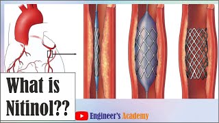 What is Nitinol [upl. by Gorga]