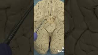 Medial temporal lobe parahippocampal gyrus neuroanatomy temporallobecortexlimbic system [upl. by Ynaffat342]