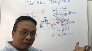 Cardiac Tamponade [upl. by Ecined]