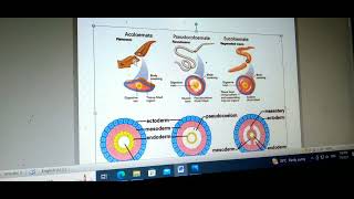 biology advance level 🦴🦹‍♀️සන්ධාරනය හා චලනය unit5 2  lesson 1✍😀 [upl. by Ayar]