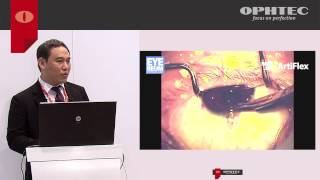 Comparison between Artiflex Toric and limbal relaxing incisions for correcting myopic astigmatism [upl. by Gustaf]