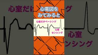 心電図検定‼️ペースメーカも出るんです！ 心電図検定 心電図 看護師 医学生 [upl. by Raval163]