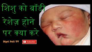 Shishu ko body rashes hone par kya kareBaby EczemaBaby ke rashes kese dur karebaby acne in hindi [upl. by Aisul]