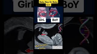 Baby Boy Or Baby Girl pregnancy Ultrasound V4 babyboy babygirl girl boy ultrasound pregnant [upl. by Eaver517]