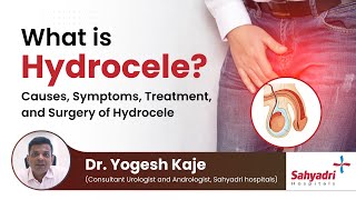 What is Hydrocele  Causes Symptoms Treatment and Surgery of Hydrocele  Dr Yogesh Kaje [upl. by Piefer]