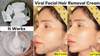 forehead hair removal waxing 😮  how to remove forehead hair hairremovalmethods hairremoval [upl. by Ecidnarb]