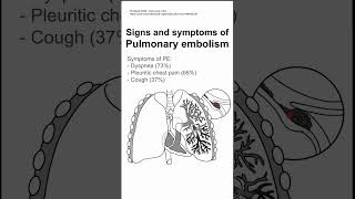 Signs and symptoms of Pulmonary embolism [upl. by Duwe49]