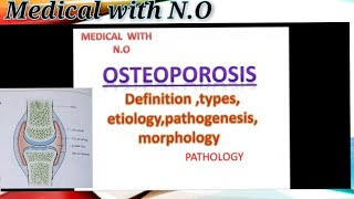 osteoporosis in hindiDEFINITION causes types pathogenesis morphology etc [upl. by Refotsirhc509]