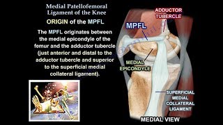 Medial Patellofemoral Ligament Of The Knee Anatomy Everything You Need To Know  Dr Nabil Ebraheim [upl. by Roderich618]