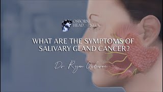 What are the symptoms of salivary gland cancer [upl. by Aicena]