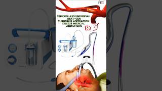 Stryker AXS Universal NextGen Thrombus Aspiration Device Medical Animation 3d short [upl. by Nyletak]