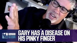 Gary Has a Disease on His Pinky Finger [upl. by Ahsyad]