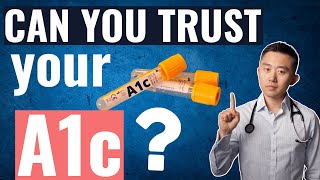 Is A1c the right test for you [upl. by Drye841]