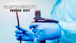 Gastrscopy Inside Out  Upper Endoscopy  Why and How Gastroscopy is done [upl. by Enellek]