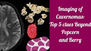 Imaging of cavernomas  Beyond Popcorn and Berry [upl. by Klarrisa]