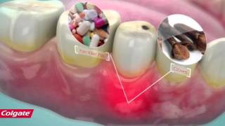 How Colgate Pain Out Works [upl. by Dallas281]