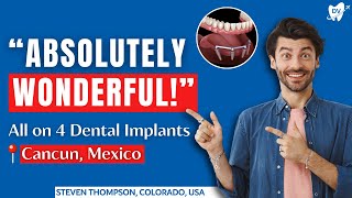 Stevens All on 4 Dental Implants in Cancun Mexico Experience [upl. by Ambur]