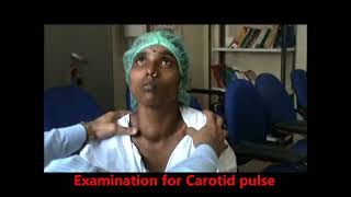 clinical examination of Goitre Thyroid examination Thyrotoxicosis [upl. by Htenay]