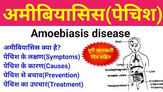 अमीबिएसिस क्या है  amoebiasis treatment symptoms causes  amoebiasis disease in hindi  पेचिश [upl. by Sinnard]