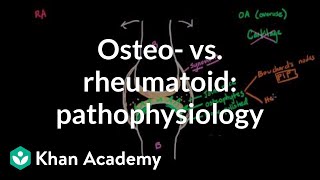 Osteoarthritis vs rheumatoid arthritis pathophysiology  NCLEXRN  Khan Academy [upl. by Esidarap55]