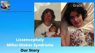 Lissencephaly and Grace Our Story [upl. by Absalom]